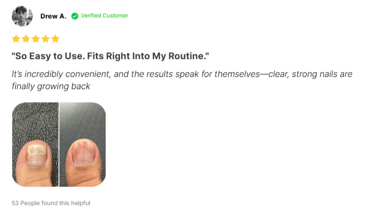 Fungabeam Customer Reviews